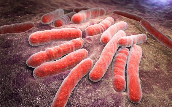 Epidemiologia i program zwalczania gruźlicy