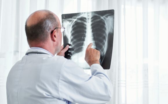 Kompleksowa diagnostyka raka płuca